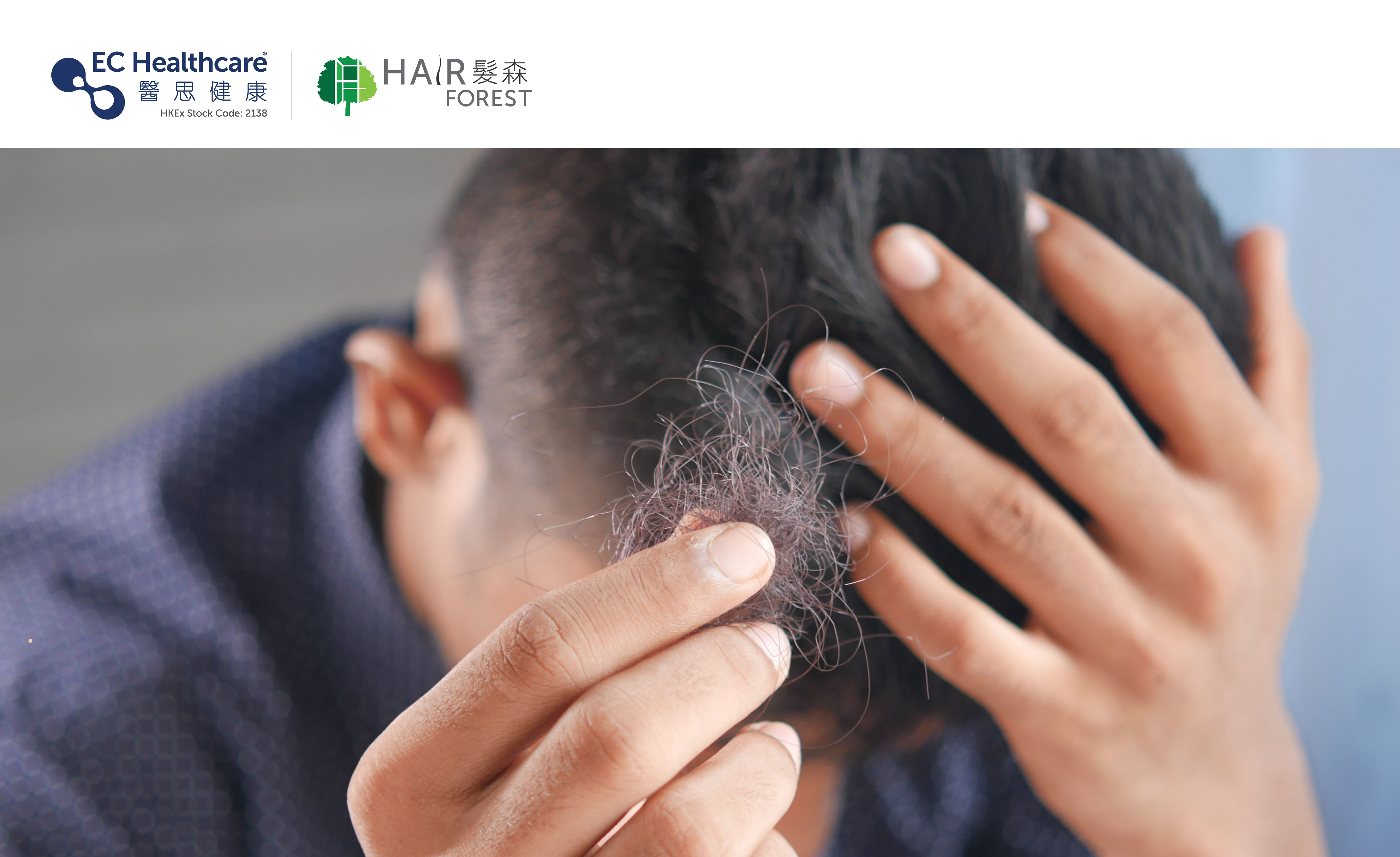 Hair SOS: 4 Ways to Spot Abnormal Loss and Save Your Strands | EC Healthcare